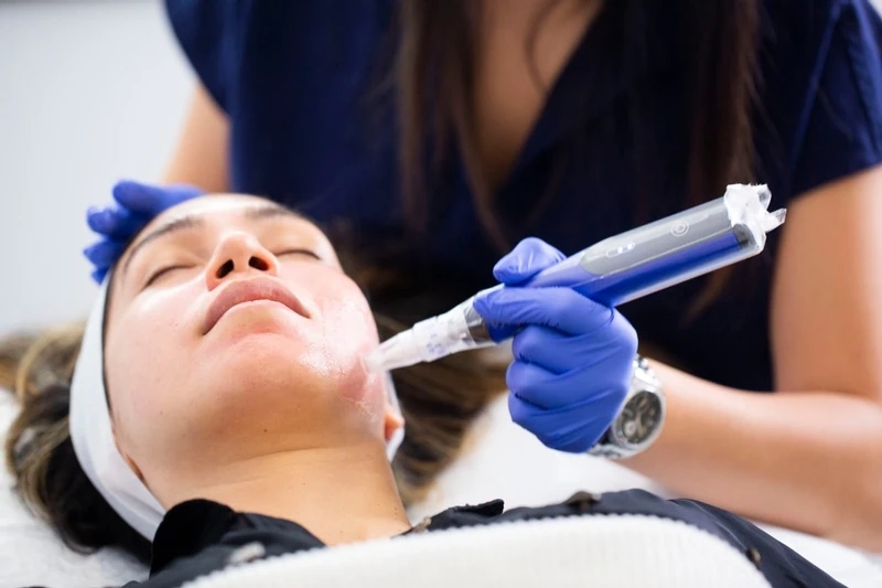 SkinPen-Microneedling-viva-medspa-in-Cranston-RI